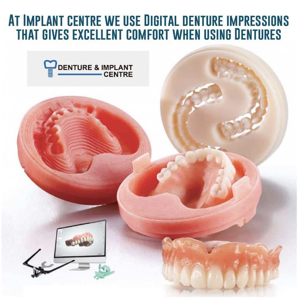 dental implant post on instagram
