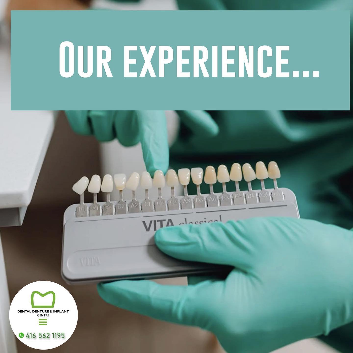dental veneers post on instagram