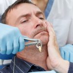 Dental Implant After a Tooth Extraction