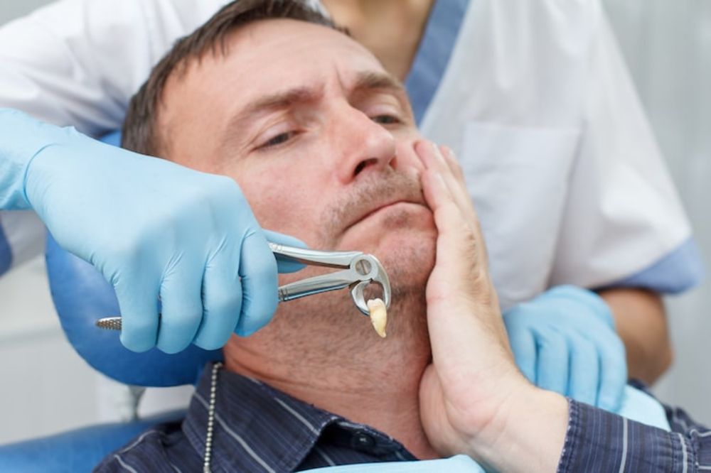 Dental Implant After a Tooth Extraction